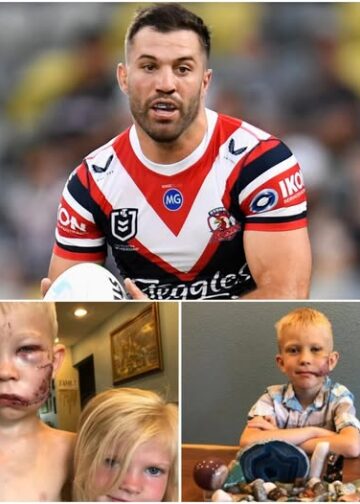 James Tedesco sends emotional gift to young hero after dog attack